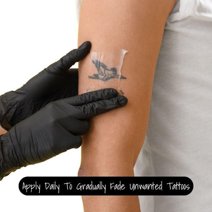 Tattoo Removal Cream - inkology-UK