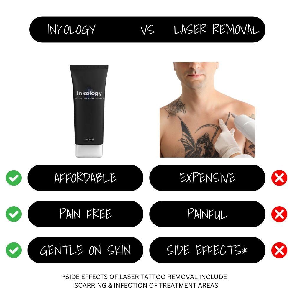 Tattoo Removal Cream - inkology-UK
